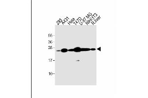 All lanes : Anti-RAB1B Antibody (C-term) at 1:2000 dilution Lane 1: 293 whole cell lysate Lane 2: A431 whole cell lysate Lane 3: Hela whole cell lysate Lane 4: T47D whole cell lysate Lane 5: U-87 MG whole cell lysate Lane 6: NIH/3T3 whole cell lysate Lane 7: rat liver lysate Lysates/proteins at 20 μg per lane.