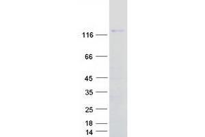 Western Blotting (WB) image for Integrin, alpha 6 (ITGA6) (Transcript Variant 2) protein (Myc-DYKDDDDK Tag) (ABIN2713733)