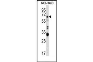 Western blot analysis of ERVFRDE1 / HERV-FRD Antibody (N-term) in NCI-H460 cell line lysates (35ug/lane). (HERV-FRD Provirus Ancestral Env Polyprotein (Herv-frd) (AA 78-107), (N-Term) Antikörper)