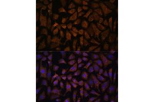 Immunofluorescence (IF) image for anti-Protein Phosphatase 2, Regulatory Subunit B', delta (PPP2R5D) (AA 450-550) antibody (ABIN7269690)