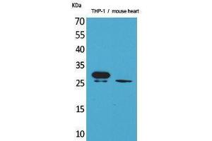 Western Blotting (WB) image for anti-Triggering Receptor Expressed On Myeloid Cells 1 (TREM1) (Internal Region) antibody (ABIN3187681) (TREM1 Antikörper  (Internal Region))