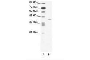 Image no. 1 for anti-Forkhead Box L2 (FOXL2) (N-Term) antibody (ABIN202373) (FOXL2 Antikörper  (N-Term))