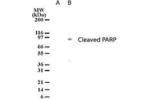 Image no. 1 for anti-Poly (ADP-Ribose) Polymerase 1 (PARP1) antibody (ABIN207909) (PARP1 Antikörper)