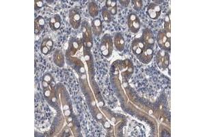 Immunohistochemical staining of human duodenum with MAMDC2 polyclonal antibody  shows moderate cytoplasmic positivity in glandular cells. (MAMDC2 Antikörper)