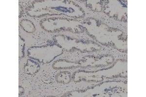 IHC analysis of ADK using anti-ADK antibody (ABIN4886430). (ADK Antikörper  (AA 165-351))