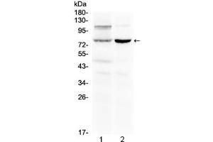 Western blot testing of 1) rat liver and 2) mouse kidney lysate with Dishevelled 2 antibody at 0. (DVL2 Antikörper  (AA 35-64))