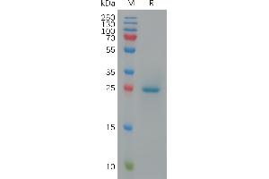 SDS-PAGE (SDS) image for Butyrophilin, Subfamily 3, Member A1 (BTN3A1) (AA 1-218) protein (His tag) (ABIN7491231)