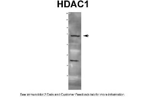 WB Suggested Anti-HDAC1 Antibody  Titration: 1 ug/ml Positive Control: Rat tissue
