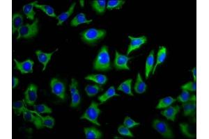 Immunofluorescence staining of A549 cells with ABIN7173285 at 1:133, counter-stained with DAPI. (TMEM88 Antikörper  (AA 109-159))