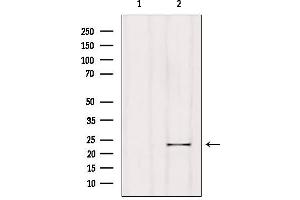Western blot analysis of extracts from Hela, using RGS1 Antibody. (RGS1 Antikörper  (Internal Region))