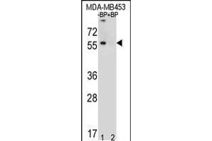 Western blot analysis of TOX3 Antibody Pab pre-incubated without(lane 1) and with(lane 2) blocking peptide in MDA-MB453 cell line lysate (TOX3 Antikörper  (AA 214-242))