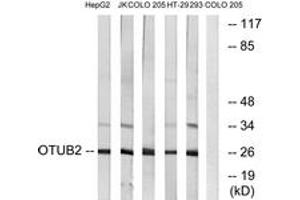 Western blot analysis of extracts from COLO/HepG2/Jurkat/293/HT-29 cells, using OTUB2 Antibody. (OTUB2 Antikörper  (AA 133-182))