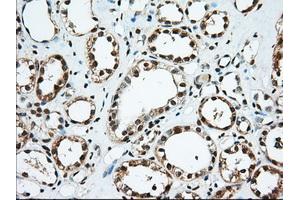 Immunohistochemical staining of paraffin-embedded Human thyroid tissue using anti-EIF2S1 mouse monoclonal antibody.