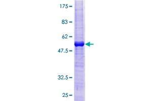 Image no. 1 for Tumor Necrosis Factor Receptor Superfamily, Member 13C (TNFRSF13C) (AA 1-184) protein (GST tag) (ABIN1323160) (TNFRSF13C Protein (AA 1-184) (GST tag))