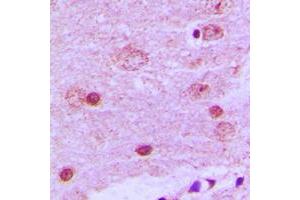Immunohistochemical analysis of PAK7 staining in human brain formalin fixed paraffin embedded tissue section. (PAK7 Antikörper  (C-Term))