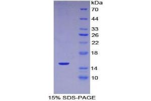 SDS-PAGE analysis of Mouse Complement 1 Inhibitor Protein. (SERPING1 Protein)