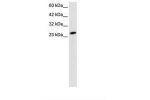 Image no. 2 for anti-TBP-Like 1 (TBPL1) (AA 88-137) antibody (ABIN202049) (TBPL1 Antikörper  (AA 88-137))