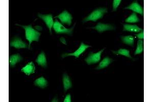 Image no. 4 for anti-Spermine Synthase, SMS (SMS) antibody (ABIN1501098) (SMS Antikörper)