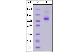 SDS-PAGE (SDS) image for Interleukin 13 Receptor, alpha 2 (IL13RA2) (AA 27-343) (Active) protein (His tag,AVI tag,Biotin) (ABIN7013665)