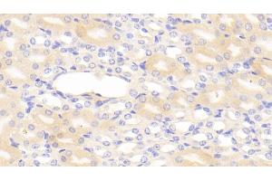Immunohistochemistry (IHC) image for anti-Serpin Peptidase Inhibitor, Clade G (C1 Inhibitor), Member 1 (SERPING1) (AA 211-331) antibody (ABIN7431431)
