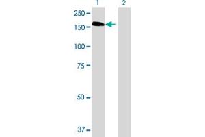 Lane 1: HDAC6 transfected lysate ( 133. (HDAC6 293T Cell Transient Overexpression Lysate(Denatured))