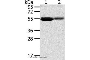 Western blot analysis of Human kidney pericarcinous and kidney cancer tissue, using SLC17A1 Polyclonal Antibody at dilution of 1:200 (SLC17A1 Antikörper)