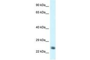 Image no. 1 for anti-NADH Dehydrogenase (Ubiquinone) Fe-S Protein 8, 23kDa (NADH-Coenzyme Q Reductase) (NDUFS8) (AA 114-163) antibody (ABIN6747459)