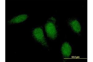 Immunofluorescence of monoclonal antibody to TTN on HeLa cell. (Titin Antikörper  (AA 1-110))