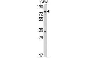 Western blot analysis of TGM4 Antibody (Center) in CEM cell line lysates (35ug/lane). (TGM4 Antikörper  (Middle Region))