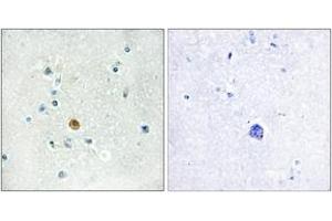 Immunohistochemistry analysis of paraffin-embedded human brain tissue, using IRF3 (Ab-396) Antibody.