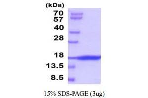 SDS-PAGE (SDS) image for KIT Ligand (KITLG) (AA 26-189) (Active) protein (ABIN5854932) (KIT Ligand Protein (KITLG) (AA 26-189))