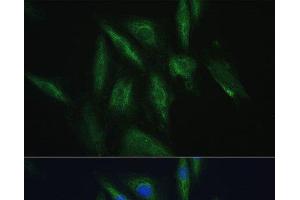 Immunofluorescence analysis of H9C2 cells using SRPRB Polyclonal Antibody at dilution of 1:100. (SRPRB Antikörper)
