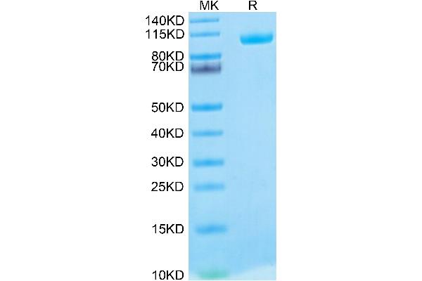 MMP 9 Protein (His-Avi Tag,Biotin)