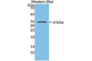 Western Blotting (WB) image for anti-Plasminogen (PLG) (AA 191-433) antibody (ABIN3207024) (PLG Antikörper  (AA 191-433))