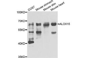 Western blot analysis of extracts of various cell lines, using ALOX15 antibody (ABIN5975430) at 1/1000 dilution. (ALOX15 Antikörper)