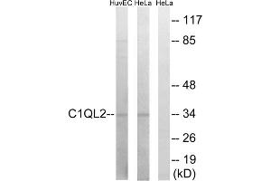 Western blot analysis of extracts from HUVEC cells and HeLa cells, using C1QL2 antibody. (C1QL2 Antikörper  (C-Term))