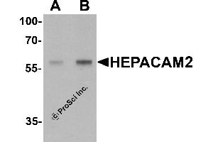 Western Blotting (WB) image for anti-HEPACAM Family Member 2 (HEPACAM2) (C-Term) antibody (ABIN1077405) (HEPACAM2 Antikörper  (C-Term))