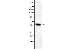 Western blot analysis of V-ATPase D1 using HeLa whole cell lysates (ATP6V0D1 Antikörper  (Internal Region))