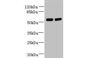 Western blot All lanes: TCTE1 antibody at 3 μg/mL Lane 1: U251 whole cell lysate Lane 2: Mouse brain tissue Secondary Goat polyclonal to rabbit IgG at 1/10000 dilution Predicted band size: 56 kDa Observed band size: 56 kDa (TCTE1 Antikörper  (AA 285-501))