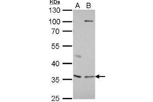WB Image Decorin antibody detects DCN protein by Western blot analysis. (Decorin Antikörper)