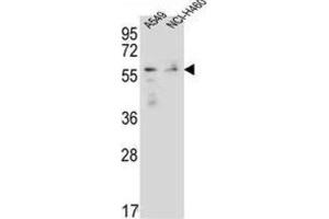 Western Blotting (WB) image for anti-Forkhead Box N1 (FOXN1) antibody (ABIN2996514) (FOXN1 Antikörper)