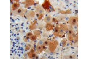 Used in DAB staining on fromalin fixed paraffin-embedded Liver tissue (TTR Antikörper  (AA 21-147))