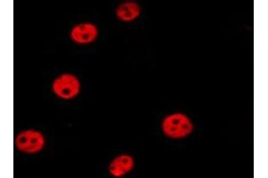 ABIN6277203 staining HepG2 by IF/ICC. (Histone 3 Antikörper  (H3K36me3))