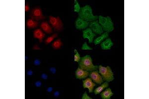 Phospho-A20/TNFAIP3 (Ser381) Antibody staining Hela cells(heat shock treatment) by IF/ICC. (TNFAIP3 Antikörper  (pSer381))