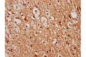 IHC image of ABIN7147330 diluted at 1:300 and staining in paraffin-embedded human brain tissue performed on a Leica BondTM system. (TMEM2 Antikörper  (AA 734-866))