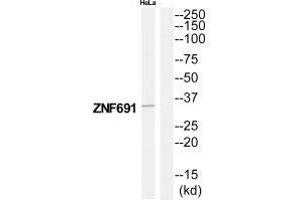 Western blot analysis of extracts from HeLa cells, using ZNF691 antibody. (ZNF691 Antikörper)