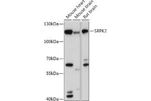 Western blot analysis of extracts of various cell lines, using SRPK2 antibody (ABIN7270269) at 1:1000 dilution. (SRPK2 Antikörper  (AA 420-520))