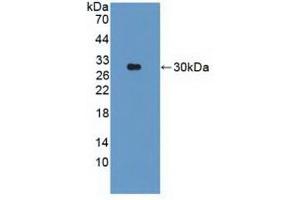 Figure. (Parkin Antikörper  (AA 229-465))