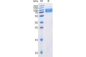 Human DNAM-1 Protein, mFc-His Tag on SDS-PAGE under reducing condition. (CD226 Protein (CD226) (mFc-His Tag))