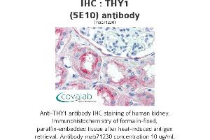 Image no. 1 for anti-CD90 (THY1) antibody (ABIN1724058) (CD90 Antikörper)